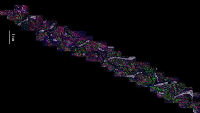 MIBI-TOF image series showing adjacent sections of bone marrow core