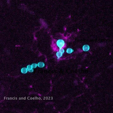 Cryptococcus yeast round forms in cyan, associated with brain immune cell in magenta in high content imaging