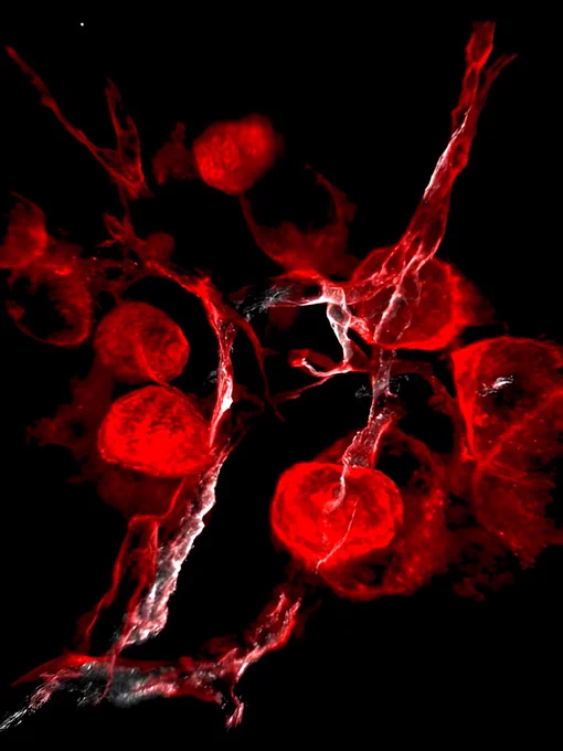 This black and red image shows the lymphatic system of an adult mouse kidney, which is very similar to in humans. It is bright in places and dark in others. The lymphatics are a draining network that help the body remove unwanted fluids and molecules from tissue, like those that cause inflammation. The system is also vital for the movement of immune cells throughout our body. This image was taken as part of research to understand how a certain protein is turned on and off across this system within the kidney and how that may impact inflammation in kidney disease.