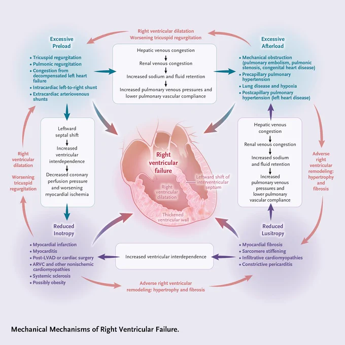Figure 1. Mechanical Mechanisms of Right Ventricular Failure.