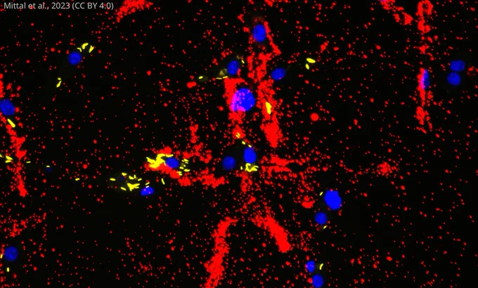 Blue, red and yellow epifluorescence microscopy image