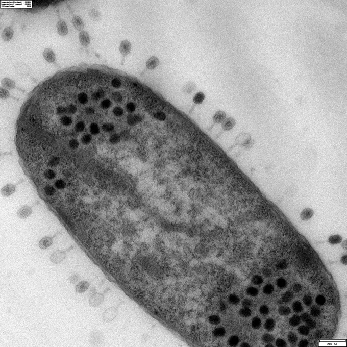 Electron micrograph of a bacterium attacked and infested by phages