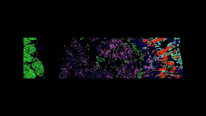 Blue – nuclei, green – muscle, magenta – epithelial, red – plasma, gray – endocrine cells, cyan – mast cells, yellow – enterocytes 