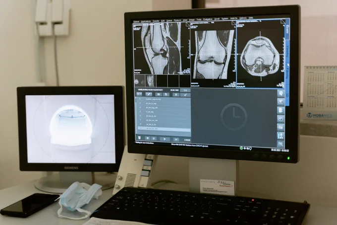 Scan of human bone joints on a computer screen