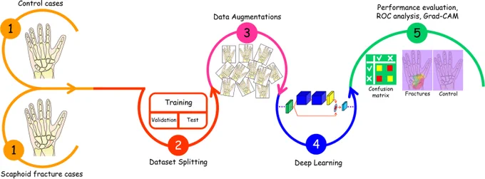 Experimental setup for scaphoid fracture detection with proposed deep learning model.