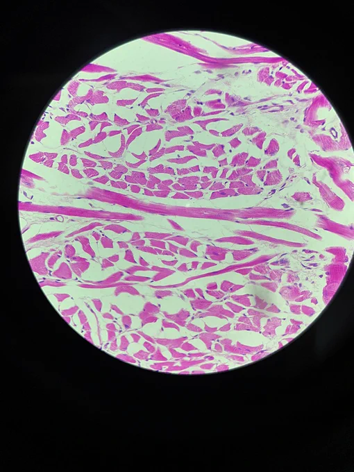 tecido muscular estriado esquelético, corte transversal