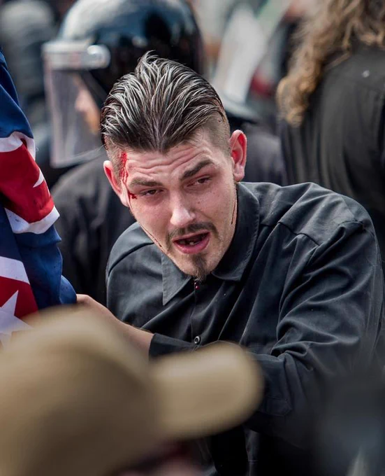 Holderfield in the UTR street crowd with a pained look on his face, blood on the sode of his forehead. He is wearing a long sleeved black shirt and is wielding a rolled up flag.

