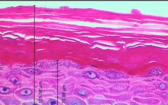 Cross-section through reconstructed human skin, cultured in the laboratory, used to test the safety of products applied to the skin. Research by the Swansea-led CALIN project, which is at risk of closure and which works closely with companies on innovation in life sciences.