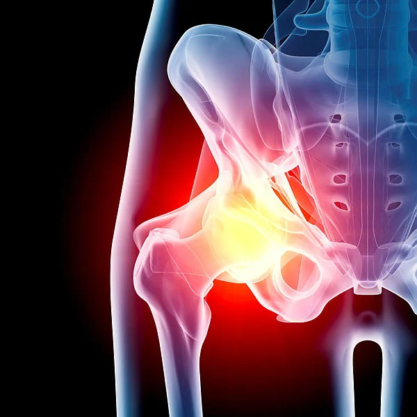 Anterior (front) x-ray view (orthogonal) of human hip