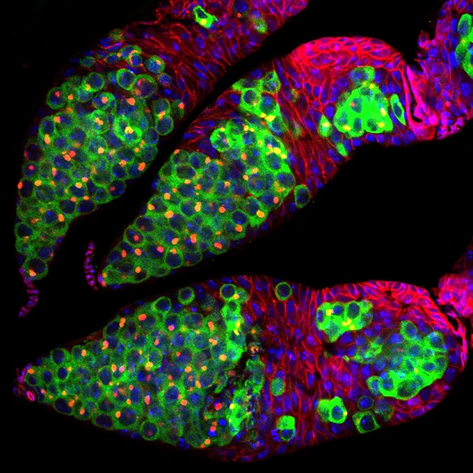 Ventures in Differentiation ​

                Production of a differentiated oocyte is a biological process reliant on heavily regulated signaling networks controlling cell division and fate. Using the fruit fly as a model organism, I investigate the intra- and inter-molecular signaling pathways required for making healthy, viable oocytes. When signaling networks fall out of balance, cells can proliferate uncontrollably and form undifferentiated germ cell tumors (in green). Progressive tumors in the germline stem cell niche halt the process of egg chamber production leading to sterility.  