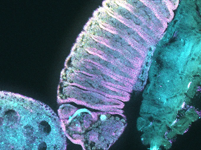 Friendly Fruit Flies​

​

What comes to mind when you think of fruit flies? Most people would answer some variation of the following: annoying, dirty, creepy, etc. When I think of fruit flies, however, I think of all the ways they have aided in the advancement of our knowledge of cell biology. Our lab utilizes fruit flies, or Drosophila melanogaster, as a model organism to further our understanding of the stem cell niche and its assembly. Here, a wild-type Drosophila embryo has been stained to allow for analysis of its gut formation.​