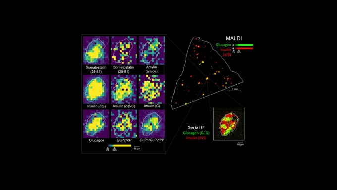 On black background, image on left shows a 3x3 images. On right, another image titled MALDI (on top right) and Serial IF (on lower right).