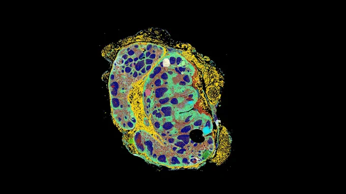 On black background, a colorful (mostly yellow, green, and purple) CODEX image of a lymph node.