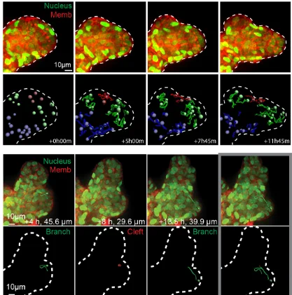 Mammary organoid branch undergoing bifurcation