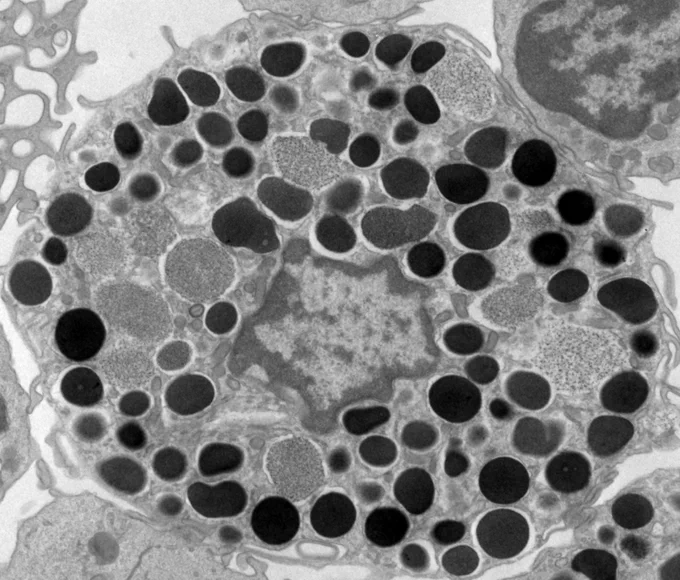 Electron microscopy image of the mast cell taken by @GIStressBio Lab