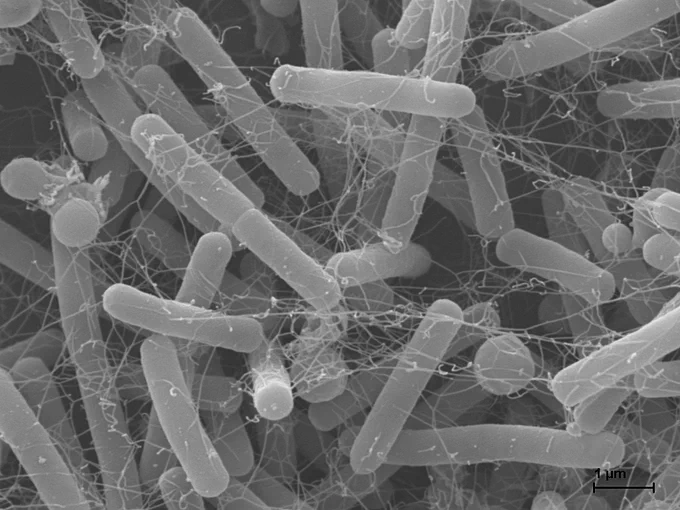 Elektronenmikroskopische Aufnahme von Clostridioides difficile. Die Zellen wurden von Nicole Metzendorf, Abteilung für Mikrobielle Physiologie & Molekularbiologie am Institut für Mikrobiologie der Universität Greifswald, zur Verfügung gestellt und von Rabea Schlüter, Imaging-Zentrum der Fachrichtung Biologie, aufgenommen.
