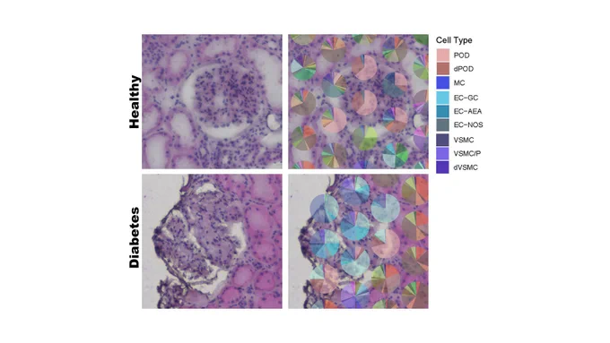 2x2 square: top 2 squares indicate healthy cell types and the  bottom 2 squares indicate a diabetic cell. 
On the right of squares is a legend showing the different cell types as seen on the right column of squares. 
The cell types indicated in the legend from top to bottom are:
POD, dPOD, MC, EC-GC, EC-AEA, EC-NOS, VSMC, VSMC/P, dVSMC