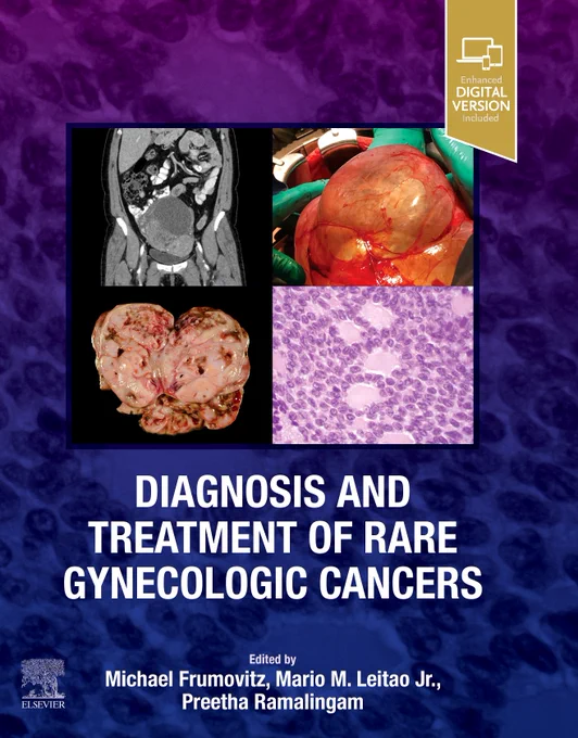 Cover of Diagnosis and Treatment of Rare Gynecologic Cancers, 1st Edition.