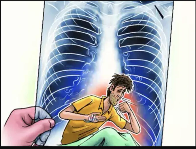 Image source : Times of India