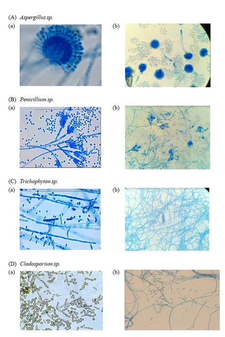 (A to D) Representative figures of Aspergillus (A), Cladosporium (B), Penicillium (C), and Trichophyton (D) in the data set. The images are obtained from two sources: (a) Google and (b) photomicrographs of touch-tape preparation of fungal culture stained with LPCB and taken using a high-power objective (40�) on a compound light microscope.