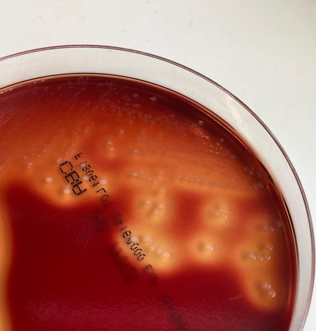 Streptococcus pyogenes on a blood agar