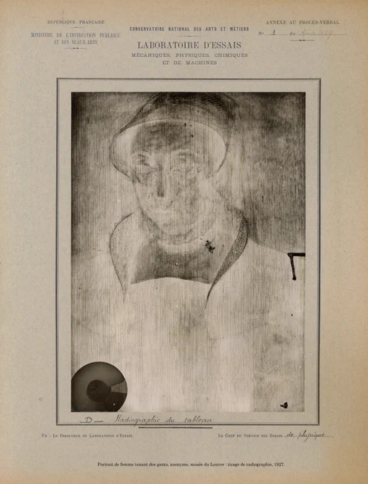 Portrait de femme tenant des gants, anonyme, musée du Louvre : tirage de radiographie, 1927.