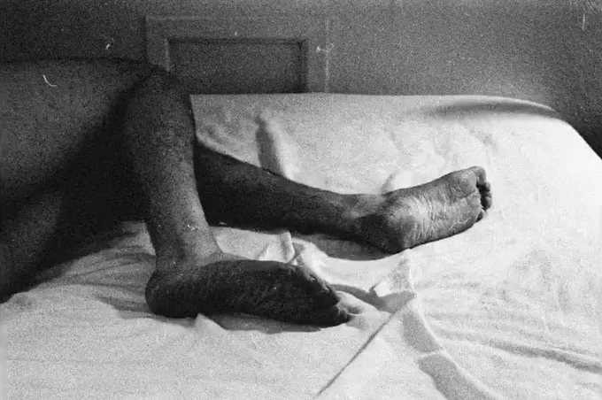 Artwork by Kev Hawken which shows a black and white photograph of a person laying on a bed, their legs and feet are in shot but the rest of the body is out of frame.