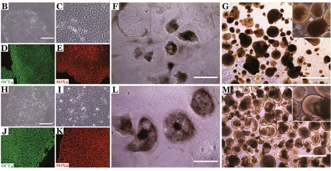 Microscopic and immunocytochemical analysis of patient iPSC lines 3 (poor producer) and 1 (good producer) at differentiation days 0, 16, and 20.
Credit: Budd Tucker, Stem Cells Transl Med. 2023 Jun; 12(6): 365–378.
Published online 2023 May 23. doi: 10.1093/stcltm/szad028