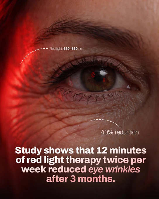 A study supported by the National Institutes of Health (NIH) found that targeted red light exposure can significantly improve skin appearance around the eyes. Participants used red light in the 630–660 nm range for 12 minutes, twice per week, over a period of three months. By the end of the study, eye wrinkle depth was reduced by around 40%, indicating measurable skin rejuvenation. Researchers suggest the effect is linked to improved mitochondrial function and increased cellular energy production in skin cells. These findings highlight red light therapy as a non-invasive approach with potential benefits for skin aging.