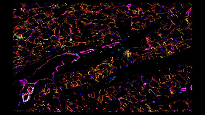 CellDIVE Image of the Heart

Nuclei - blue, Immune cells - green, basement membrane - red, cardiomyocyte membranes - yellow, smooth muscle cells - cyan, endothelial cells - magenta