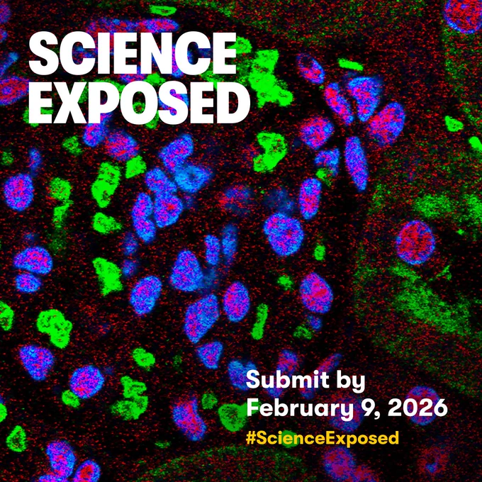 IMAGE: In the background, we see one of the finalist images of our "Science Exposed 2025" contest, a fluorescence microscopy image of kidney cells showing the effects of ischemia, a condition in which oxygen supply to the kidney is reduced, impairing organ function. On top of the image we see, in white, the title of the context and “Submit by February 9, 2026” as well as the hashtag #ScienceExposed in yellow. (Background image by Elizabeth Anim from McGill University).