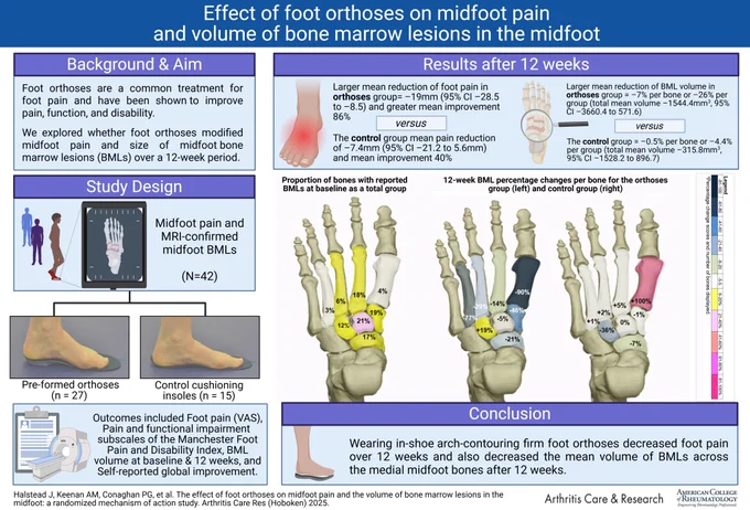 The effect of foot orthoses on midfoot pain and the volume of bone marrow lesions in the midfoot: a randomized mechanism of action study. Graphical abstract created using BioRender