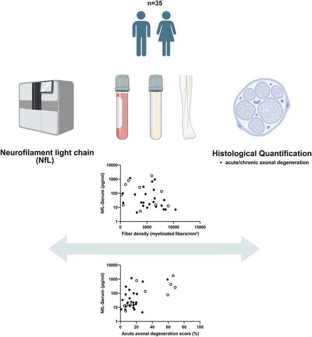 To assess neurofilament light chain (NfL) as a biomarker of peripheral nerve damage, we correlated serumNfL concentrations with histopathological parameters from matched sural nerve biopsies. SerumNfL levels correlated with markers of acute axonal degeneration, but not with parameters reflecting chronic axonal loss.