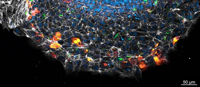 An image of migrating neural crest cells in an ex vivo explant taken at 20X magnification using a Zeiss Imager.M2 with Apotome. Blue= nuclei, white=phalloidin/filamentous actin, orange= EB1 and green=beta actin. The cells look like a galaxy.