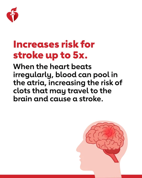 Learn more at https://www.heart.org/en/health-topics/atrial-fibrillation.
