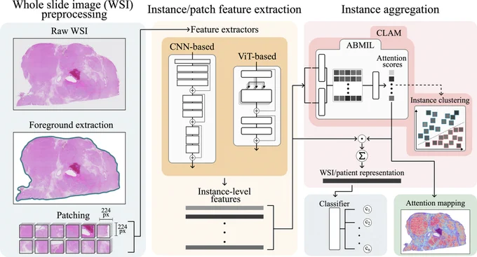 Deep learning-based feature extractors pretrained on histopathology images can classify pediatric brain tumors when applied to a multi-center Swedish dataset.