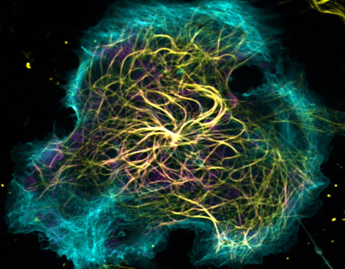 Cell expressing a mutant version of WDR90 displays overly stabilized and curvy microtubules