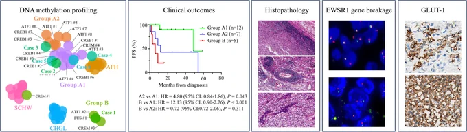 Six new cases of intracranial mesenchymal tumors with FET::CREB fusion, alongside 20 previously reported cases underwent DNA methylation profiling uncovered a novel epigenetic subgroup distinguished by inferior PFS and unique clinicopathological, molecular, and epigenetic hallmarks. GLUT-1 could serve as a potential diagnostic indicator in IMTs with FET::CREB fusion.