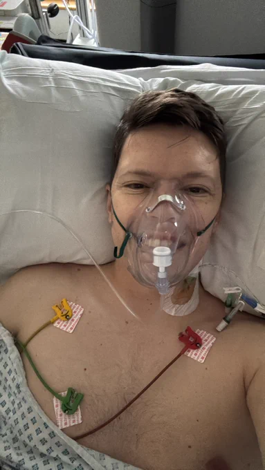 Luke taking a selfie of himself in hospital. He has an oxygen mask over his face and several medical sensors attached to their chest.
