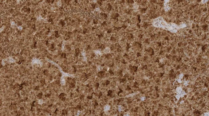 Calretinin 