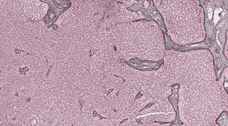 Reticulin