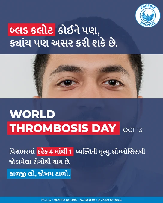 Thrombosis is a silent threat. Every 1 in 4 deaths globally is linked to thrombosis.
Today, on World Thrombosis Day, we remind you - blood clots can affect anyone, anywhere.

Early recognition & timely treatment can save lives.

#WorldThrombosisDay 
#PhoenixHospital #Ahmedabad