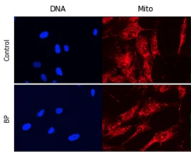mitochondria are more compact near the nucleus in cells from patients with bipolar disorder as compared to controls in these images. Control patients' mitochondria are more evenly dispersed towards the cell edges