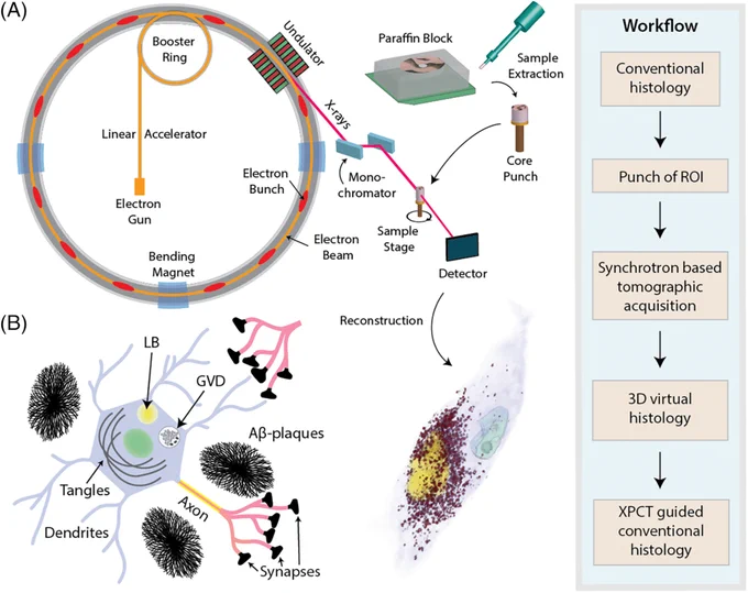 X-ray phase-contrast tomography enabled three-dimensional, label-free visualization and quantification of protein aggregates in neurodegenerative diseases with isotropic submicrometer resolution. The study revealed distinct electron density patterns in Lewy bodies, Hirano bodies, granulovacuolar degeneration, and amyloid plaques, highlighting their subcellular structure and spatial organization.