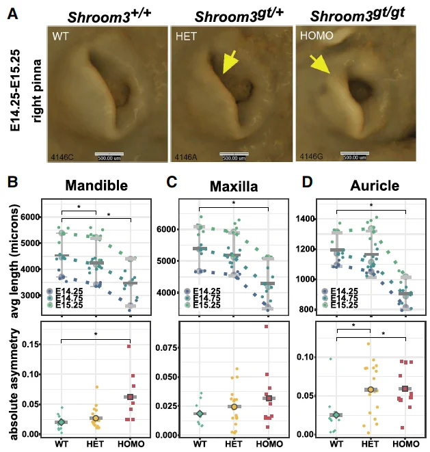 Shroom3 morphometrics image from Zhu et al 2025