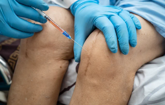 Stem cell therapy.