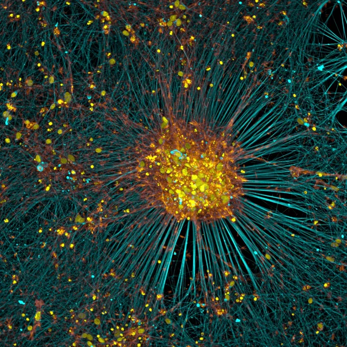 Microscopic view of a neural network with glowing yellow cell bodies connected by blue filamentous axons and dendrites.