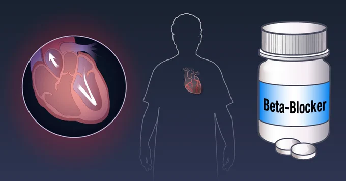 A visual presentation of the REBOOT trial, which addresses whether beta-blocker use after myocardial infarction reduces the risk of death in patients without a reduced ejection fraction.
