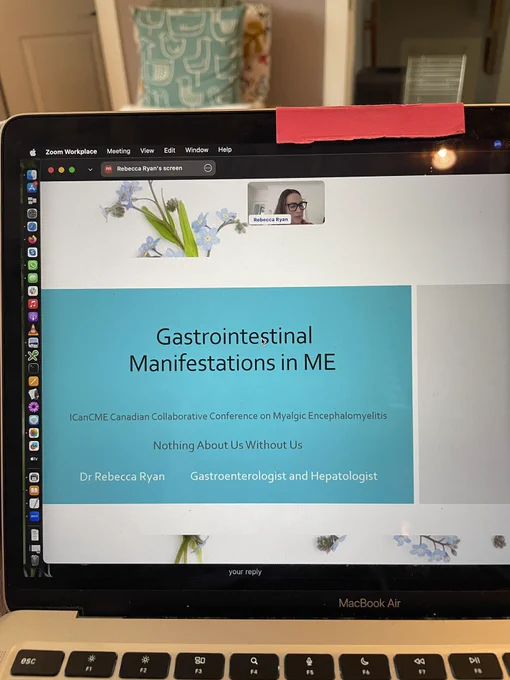 Photo of zoom opening slide