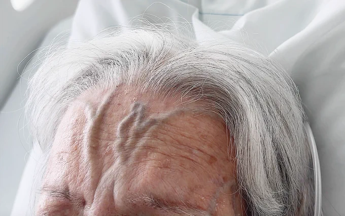 A photo of the patient's forehead